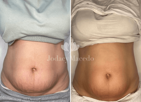 jmc-clinic-safe-prenatal-lymph-therapy.webp