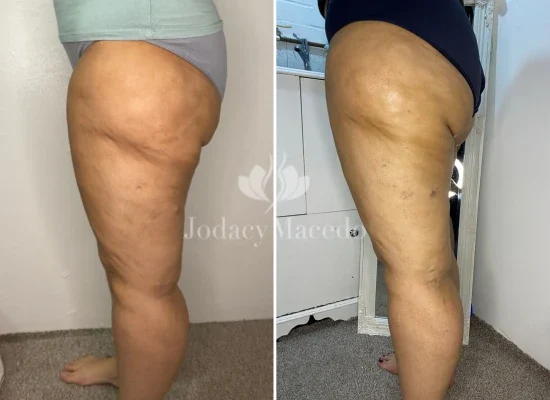 jodacy-macedo-clinic-lymphedema-massage-service.webp